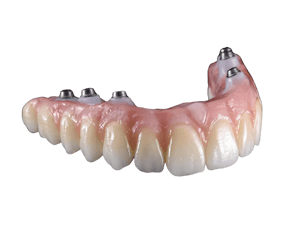 dental 5